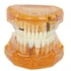 thumbnail image 2 of Modelo de implante ANGGREK 1 pieza color Naranja, 2 of 8