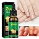 thumbnail image 5 of Líquido para el cuidado de uñas de jengibre Todas las fórmulas Cuidado de manos y pies Líquido fortalecedor de uñas Líquido reparador de uñas 30 ml fold hode, 5 of 5