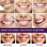 Purple Toothpaste for Teeth Whitening,Teeth Whitening Toothpaste,Cleaning Oral Cavity Refreshing,Tooth Stain Removal,Tooth Stain Removal Colour Corrector