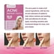 thumbnail image 5 of Mascarilla reparadora para el acné Jaysuing 10 unidades, 5 of 5