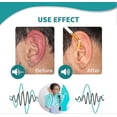 thumbnail image 4 of Tinnitus Relief For Ringing Ears, Natural Herbal Formula Tinnitus Treatment, Ear Ringing Relief Drops, Tinnitus Oil Effectively Improve Hearing For Me, 4 of 5
