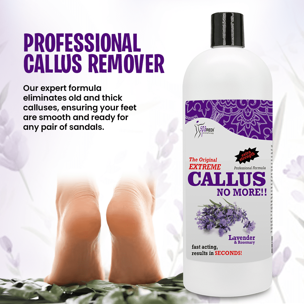SPA REDI Callus Remover - Removes Toughest Calluses in Seconds and Smooths Dry Cracked Heels, Softens and Smooths Feet, Lavender & Rosemary - 32 Oz