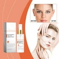 thumbnail image 1 of Nose Strips Collagen Spray 50ML Moisturizing And Firming Skin, 1 of 8