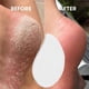 thumbnail image 5 of Lima de vidrio profesional para pies, removedora de callos con mango ergonómico para talones y pies suaves, eliminación eficaz de piel muerta para pedicuras en casa. Aestivo | Transparente |, 5 of 7
