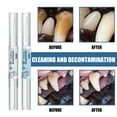 thumbnail image 2 of POINTERTECK 5ml Pets Teeth Cleaning Tool Dogs Cats Tartar Remover Dental Stones Scraper Plastic Cleaning Pen Cleaning Tools, 2 of 4