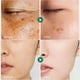 thumbnail image 5 of Crema para manchas oscuras para rostro, 50 ml/1.7 fl.oz, antienvejecimiento, 5 of 9