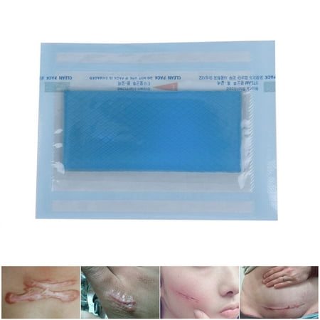 1Pc Scar Remove Trauma Burn Silicon Patch Reusable Acne Gel Skin Repair (Best Way To Remove Acne Scars)