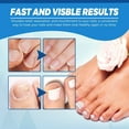 thumbnail image 3 of Non-Invasive Skin and Removal Pen Advanced Dark Corrector for Face Body Safe Gentle All Skin Types, 3 of 8