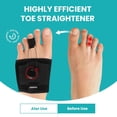 thumbnail image 3 of Promifun Hammer Toe Straightener Toe Corrector Toe Straighteners Crooked Curled Toes Foot Pain Relief,Single Hole,Black, 3 of 8