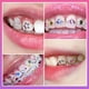 thumbnail image 5 of Gemas dentales Kit de gemas para dientes, joyería de cristales artesanal, adornos para dientes, decoración de dientes, herramienta para dientes, 5 of 5