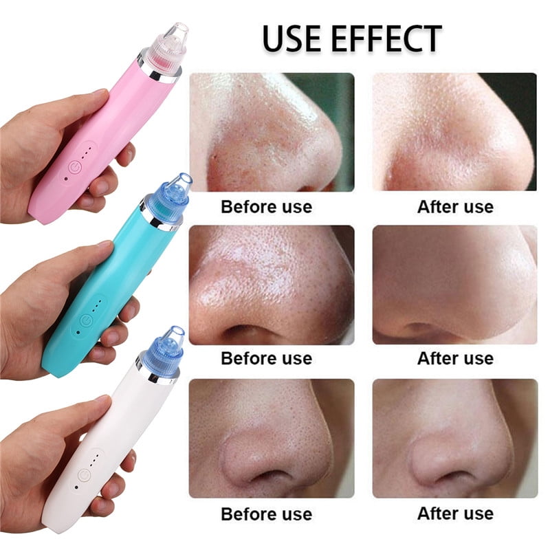 nose vacuum
