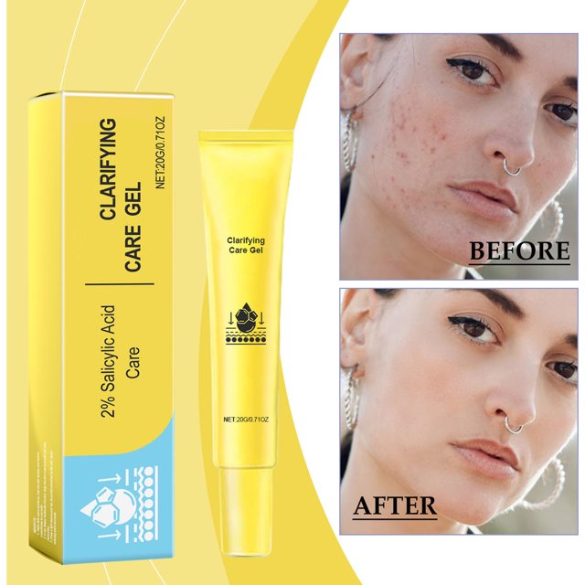 Xihbxyly Liquidación de verano Gel corrector facial Lighten Deep Clean 20 g