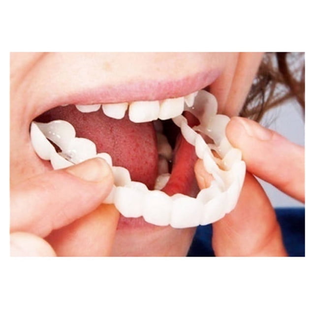 Dientes falsos, dentadura postiza, carillas temporales a presión, cubren los dientes imperfectos, arreglan una sonrisa segura, dientes falsos temporales