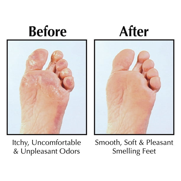 Miracle of Aloe Foot Repair Cream, 60% Ultra Aloe, Moisturizer for