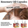 thumbnail image 3 of 30pcs Rosemary Hair Tonic Stimulates Essential Oil For Anti Hair Loss Hair Growth Nourishment Scalp Hair F, 3 of 5