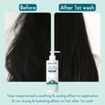thumbnail image 3 of WishCare Hydrating AHA BHA Anti Dandruff Shampoo For Women & Men-Paraben & Sulphate Free Shampoo 250ml, 3 of 7