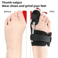 thumbnail image 3 of Hyasfey Bunion Corrector for Men Women Orthopedic Bunion Splint Brace for Pain Relief Adjustable Bunion Correction Toe Straightener for Hallux Valgus Foot Care, 3 of 7