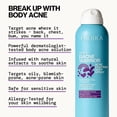 thumbnail image 3 of Pacifica Bacne Warrior 2% Salicylic Acid Acne Fighting Body Spray for Unisex, 6 fl oz, 3 of 10