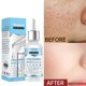thumbnail image 2 of Xihbxyly Suero Hialurónico, Solución Hidratante Antiarrugas, Esencia Iluminadora Que Reduce Los Poros, Hidratación Refrescante y Control de La Grasa, Rutina Diaria de Cuidado de La Piel, Apto para To, 2 of 7