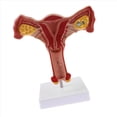 thumbnail image 2 of 3X 1:1 Modelo de Trompas de Falopio de Ovario de Útero Femenino Humano Modelo Anatómico de Anatomía Herramientas de Enseñanza, 2 of 5