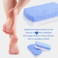 thumbnail image 2 of ZheElen 2pack/lot Easy To Clean Pumice Stone Round Edge For All Ages Foot Rasp Stone Mild, 2 of 6