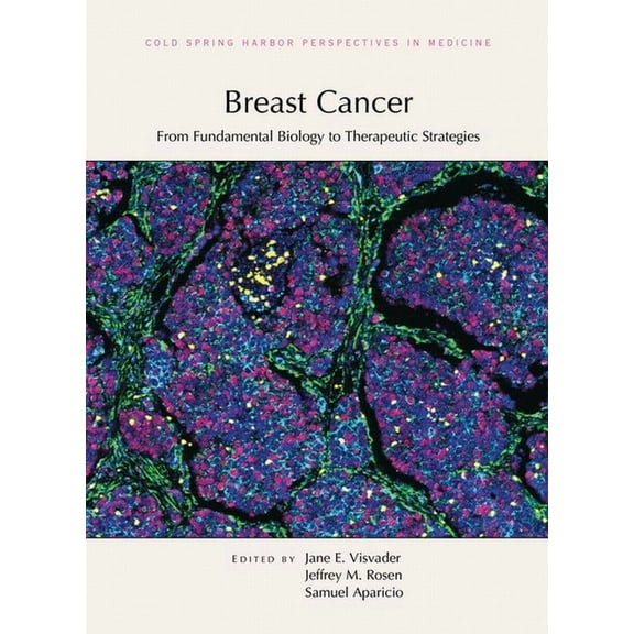 Breast Cancer: From Fundamental Biology to Therapeutic Strategies, (Hardcover)