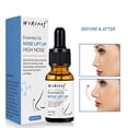 thumbnail image 1 of Fiudx Aceite Nose Up, Hidratante Nasal a Base de Hierbas, para El Desarrollo Del Cartílago Nasal, Gotas para Moldear La Nariz, para Todo Tipo de Piel, Solo para Uso Externo, Frasco de 10 Ml, 1 of 6
