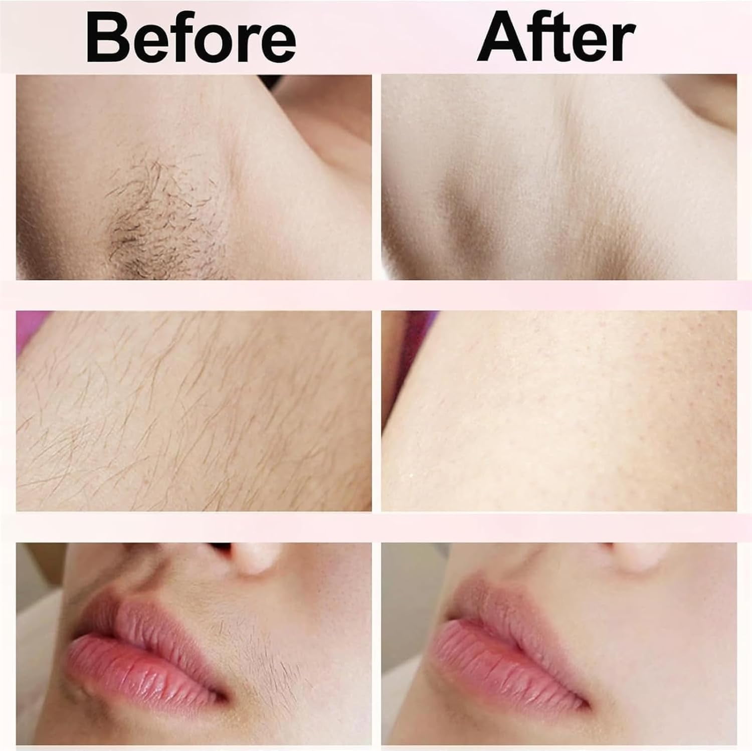 Electric Intimate Hair Trimmer for Women, Double Sided Electric Bikini Trimmer Waterproof, Shaver and Razor Rechargeable 2-in-1 Body and Facial Epilator, Painless Electric Razors for Skin