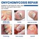 thumbnail image 5 of Multi Purpose Fungal-Nail Renewal Stickers, Strengthens Moisturizes Nail Care Stickers, for Nails Care Supplies, 5 of 5