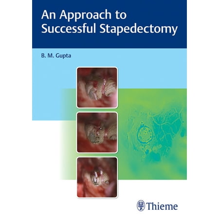 UPC: 9789390553105 | An Approach to Successful Stapedectomy (Hardcover)