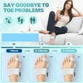 thumbnail image 2 of Upgraded Bunion Corrector for Women & Men, Orthopedic Bunions Correction with Non Slip Big Toe Separators, Adjustable Bunion Splint Suitable for Left/Right Feet Bunion Relief (1PCS), 2 of 7