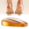 thumbnail image 2 of HILABEE Manual Foot Callus Remover Washable for Dead Artifact Peeling Yellow, 2 of 5