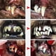 thumbnail image 5 of Electric Toothbrush for Dogs - Dog Dental Scaler Non-Slip Grooming Tools Pets Dental Care Tool Kit, 5 of 5