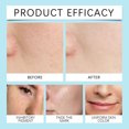 thumbnail image 3 of Tónico facial de control de aceite de glicerina para minimizar los poros 120ml | Tónico facial hidratante con hidratación profunda para pieles grasas | Loción Compresa Húmeda Repairing Skin Barrier, 3 of 7