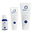 thumbnail image 3 of OMIC Acne Cure Facial Wash 60ml Acne Treatments for Women, 3 of 3