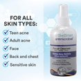 SkinSmart NonToxic Face Wash for Acne, Hypochlorous Acid Technology for Teen Athletes & Adults