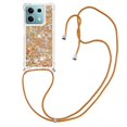 thumbnail image 1 of Funda FOXDOCK para Xiaomi Redmi Note 13 5G con Cuerda Ajustable, Brillo Líquido, Protección Antigolpes y Lente – Ideal para Regalo, 1 of 6