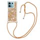 thumbnail image 1 of Funda FOXDOCK para Xiaomi Redmi Note 13 5G con Cuerda Ajustable, Brillo Líquido, Protección Antigolpes y Lente – Ideal para Regalo, 1 of 6