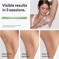 thumbnail image 4 of Braun IPL Laser Hair Removal for Women, Silk Expert Mini 1103, Permanent Hair Reduction, 4 of 11