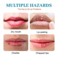 thumbnail image 3 of Queilitis Crema Antibacterial Labios Agrietados Ungüento, 3 of 10
