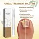 thumbnail image 5 of Toenail Renewal Solution Extra Strength Care for Toe Nail & Fingernails, Nail Repair Solution for Thick, broken, Discolored Nails 3ml, 5 of 5