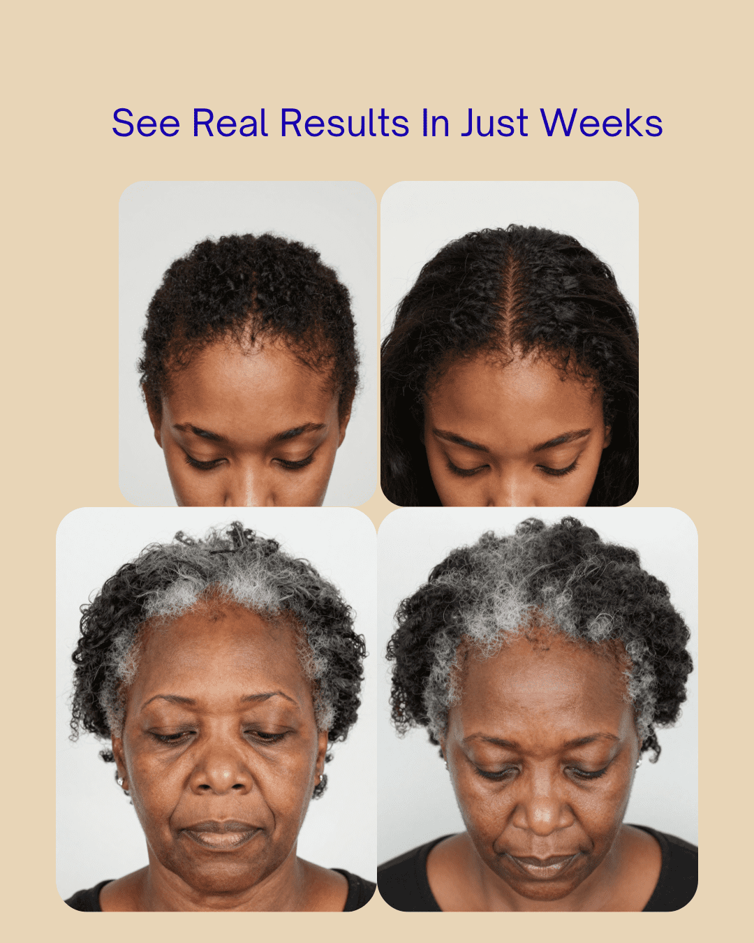 Root Revive Hair Growth Formula, 60 Capsules with Biotin, Vitamins and Herbal Blend - Made in the USA