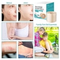 thumbnail image 2 of Silicone Scar Tape for Mark Fading - Easy Cutting Silicone Strips for Body Skincare & C-Section Comfort - Waterproof Protective Skin Barrier Roll for Sensitive Skin, 2 of 6