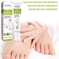 thumbnail image 4 of Gel de eliminación de hongos en las uñas ungüento antihongos para el cuidado de las uñas esencia nutritiva para el cuidado de las uñas, 4 of 9