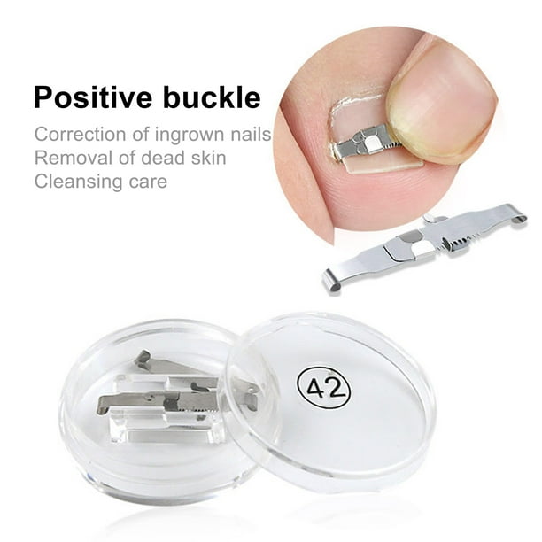 Grofry Ingrown Toenail Treatment Good Flexibility Professional