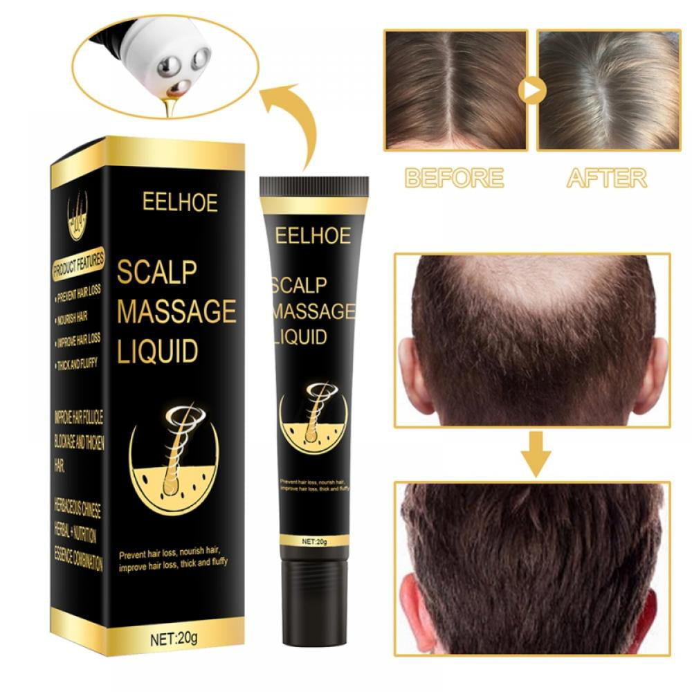 Scalp Massage Liquid, Hair Growth, Prevent & Improve Hair Loss, Hair  Anti-striping & Oil Control Clean Hair Follicles 