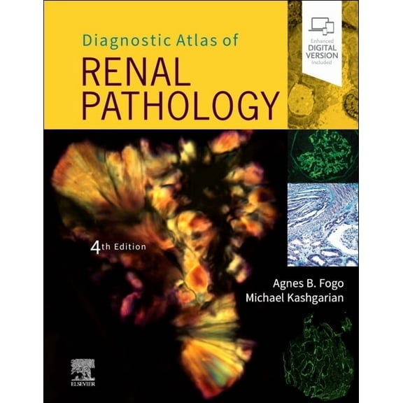 Diagnostic Atlas of Renal Pathology, (Hardcover)