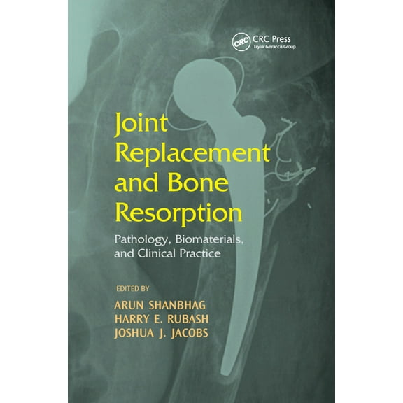 Joint Replacement and Bone Resorption: Pathology, Biomaterials and Clinical Practice, (Paperback)
