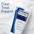 PanOxyl Max Strength Acne Foaming Wash, Face & Body, 10 Benzoyl