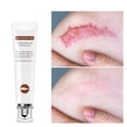 thumbnail image 1 of Crema Para Cicatrices Crema Para Estrías No Irritante Eliminación De Cicatrices Para La Cara O El Cuerpo ANGGREK  No, 1 of 7